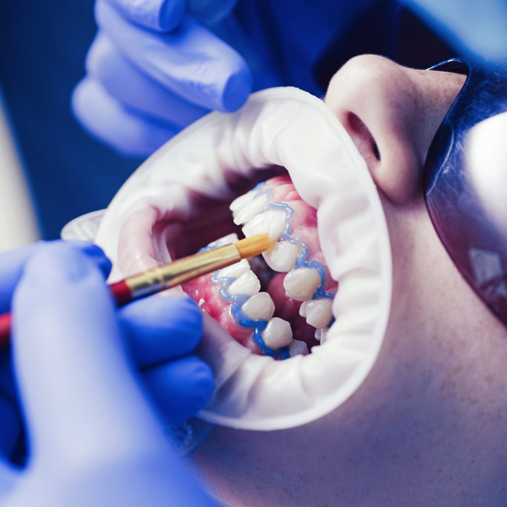 Close-up,Portrait,Of,A,Female,Patient,At,Dentist,In,The